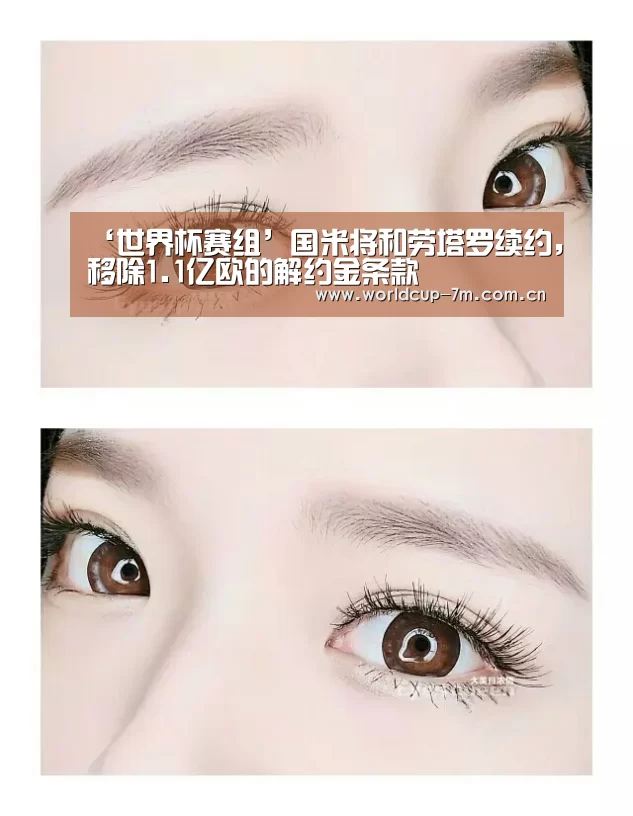 世界杯赛组